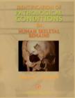 Identification of Pathological Conditions in Human Skeletal Remains - eBook