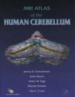 MRI Atlas of the Human Cerebellum - eBook