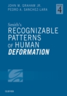Smith's Recognizable Patterns of Human Deformation E-Book - eBook
