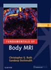 Fundamentals of Body MRI E-Book - eBook