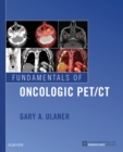Fundamentals of Oncologic PET/CT - eBook