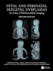 Fetal and Perinatal Skeletal Dysplasias : An Atlas of Multimodality Imaging - Book
