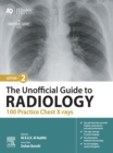 The Unofficial Guide to Radiology: 100 Practice Chest X-rays - E-Book - eBook
