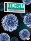 Leukemia : True Survival Stories - eBook