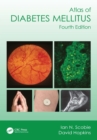 Atlas of Diabetes Mellitus - eBook