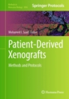 Patient-Derived Xenografts : Methods and Protocols - eBook