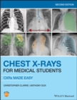 Chest X-Rays for Medical Students : CXRs Made Easy - Book