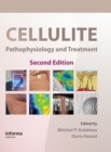 Cellulite : Pathophysiology and Treatment - eBook