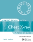 Making Sense of the Chest X-ray : A hands-on guide - eBook
