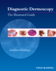 Diagnostic Dermoscopy : The Illustrated Guide - eBook
