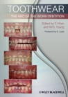 Toothwear : The ABC of the Worn Dentition - eBook