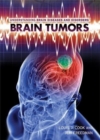 Brain Tumors - eBook