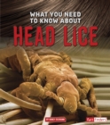 What You Need to Know about Head Lice - eBook