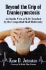 Beyond the Grip of Craniosynostosis : An Inside View of Life Touched by the Congenital Skull Deformity - eBook