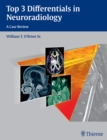 Top 3 Differentials in Neuroradiology : A Case Review - eBook