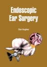 Endoscopic Ear Surgery - eBook