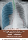 The Unofficial Guide to Radiology : 100 Practice Chest X-Rays, with Full Colour Annotations and Full X-Ray Reports - eBook