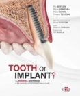 Tooth or Implant - Book