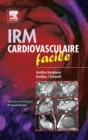 IRM cardiovasculaire facile - eBook