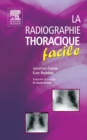 La radiographie thoracique facile - eBook