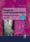 Imagerie musculosquelettique : pathologies generales - eBook