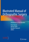 Illustrated Manual of Orthognathic Surgery : Osteotomies of the Mandible - eBook