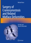 Surgery of Craniosynostosis and Related Midface Deformities : An Atlas and Step-by-Step Guide - eBook