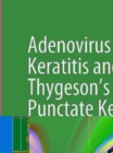 Adenovirus Epithelial Keratitis and Thygeson's Superficial Punctate Keratitis : In Vivo Morphology in the Human Cornea - eBook