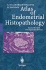 Atlas of Endometrial Histopathology - eBook