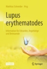 Lupus erythematodes : Information fur Erkrankte, Angehorige und Betreuende - eBook