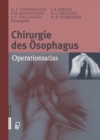 Chirurgie des Osophagus : Operationsatlas - eBook
