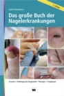 Das groe Buch der Nagelerkrankungen : Ursache, Podologische Diagnostik, Therapie, Prophylaxe - eBook