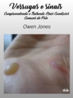 Verrugas E Sinais : Entendendo E Tratando Essas Doencas De Pele Comuns - eBook