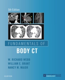 Fundamentals of Body CT E-Book