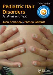 Pediatric Hair Disorders : An Atlas and Text, Third Edition