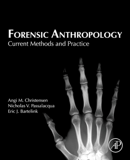 Forensic Anthropology : Current Methods and Practice, EPUB eBook