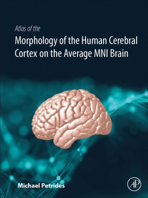 Atlas of the Morphology of the Human Cerebral Cortex on the Average MNI Brain, Hardback Book