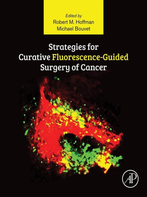 Strategies for Curative Fluorescence-Guided Surgery of Cancer, EPUB eBook