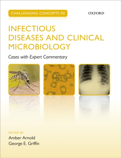 Challenging Concepts in Infectious Diseases and Clinical Microbiology : Cases with Expert Commentary, EPUB eBook