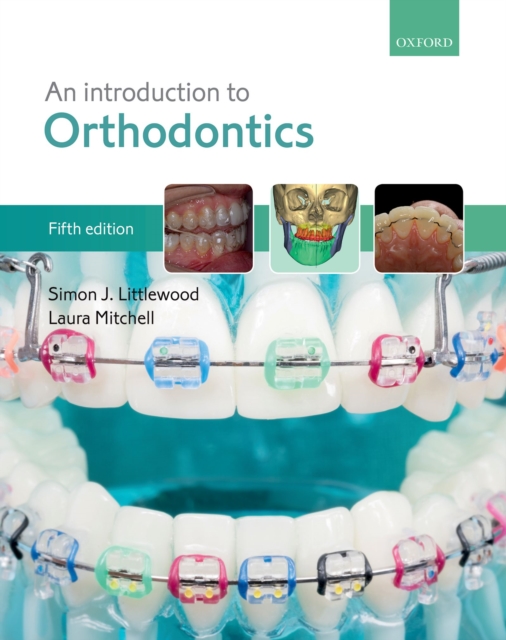 An Introduction to Orthodontics, PDF eBook