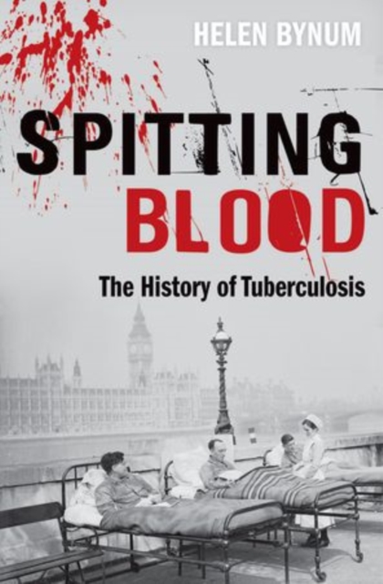 Spitting Blood : The history of tuberculosis, Paperback / softback Book