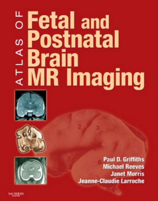 Atlas of Fetal and Postnatal Brain MR, EPUB eBook