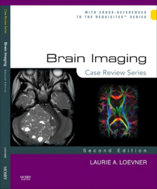 Brain Imaging: Case Review Series E-Book : Brain Imaging: Case Review Series E-Book, PDF eBook