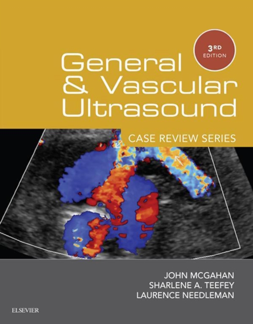 General and Vascular Ultrasound: Case Review Series E-Book, EPUB eBook