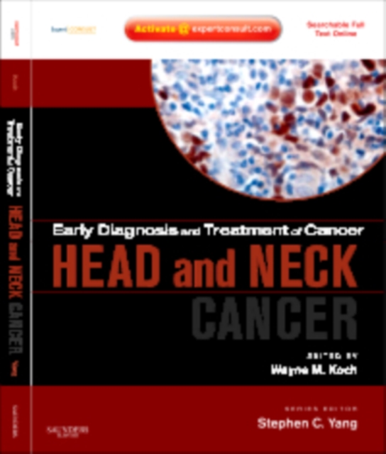 Early Diagnosis and Treatment of Cancer Series: Head and Neck Cancers E-Book, PDF eBook