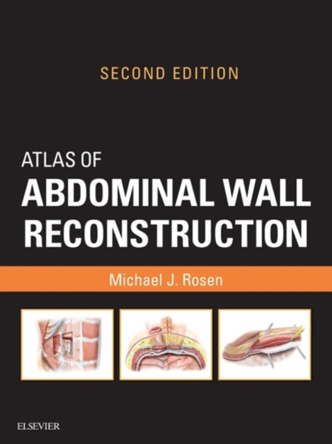 Atlas of Abdominal Wall Reconstruction E-Book : Atlas of Abdominal Wall Reconstruction E-Book, EPUB eBook