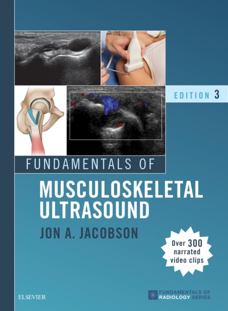 Fundamentals of Musculoskeletal Ultrasound E-Book : Fundamentals of Musculoskeletal Ultrasound E-Book, EPUB eBook