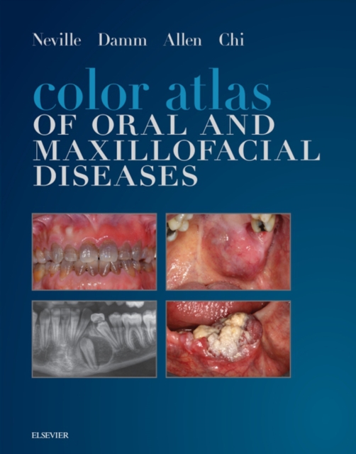 Color Atlas of Oral and Maxillofacial Diseases - E-Book : Color Atlas of Oral and Maxillofacial Diseases - E-Book, EPUB eBook