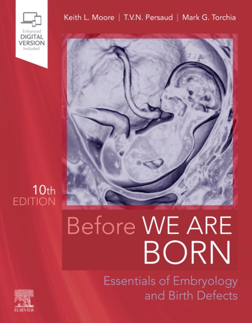 Before We Are Born : Essentials of Embryology and Birth Defects, Paperback / softback Book