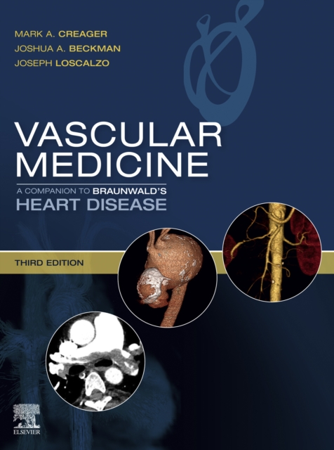 Vascular Medicine: A Companion to Braunwald's Heart Disease E-Book, EPUB eBook